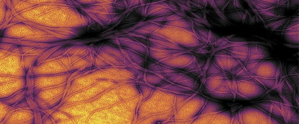 Prions as Microbes