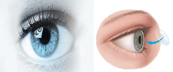 There Is Only One Way To Live After Your Death Donate Your Eyes