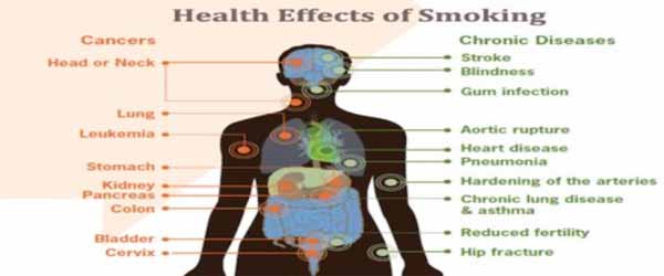 Health Effects of Smoking