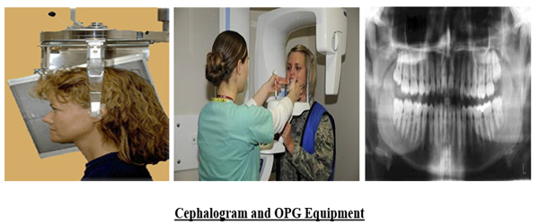 Specialized Dental Radiography X-Ray Equipment